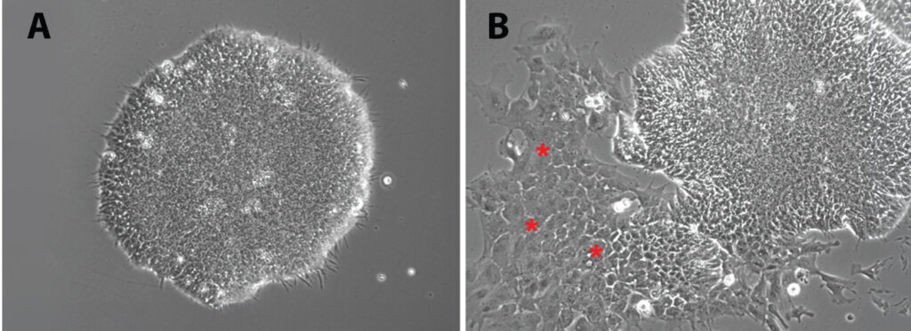 Microscopic images of iPSC colonies showing a high-quality pluripotent iPSC colony with compact morphology and uniform boundaries compared with a differentiated iPSC colony displaying fibroblast-like cells and irregular edges.